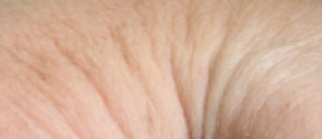 zoom sur une peau ridée