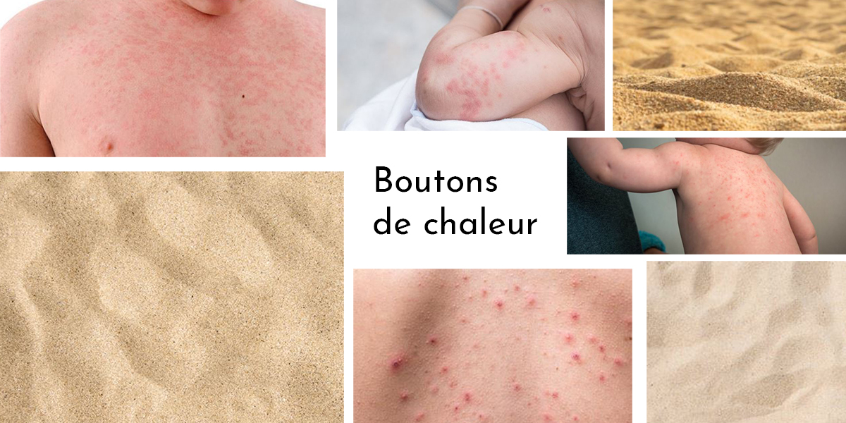 Un ensemble de photos montrant les différentes formes des boutons de chaleur